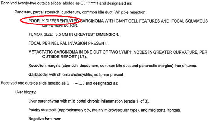 东北胰腺癌患者出国看病经历