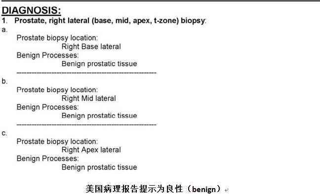 前列腺癌治疗，柳暗花明又一村