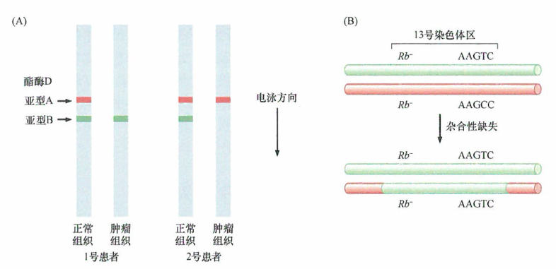 美国看病：儿童从父母遗传两种不同的酯酶D等位基因