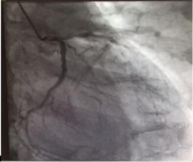 赴美就医 重拾健康，收获感动