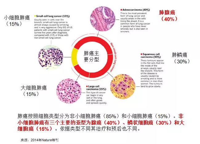 出国看病 美国治疗肺癌排名较好的医院