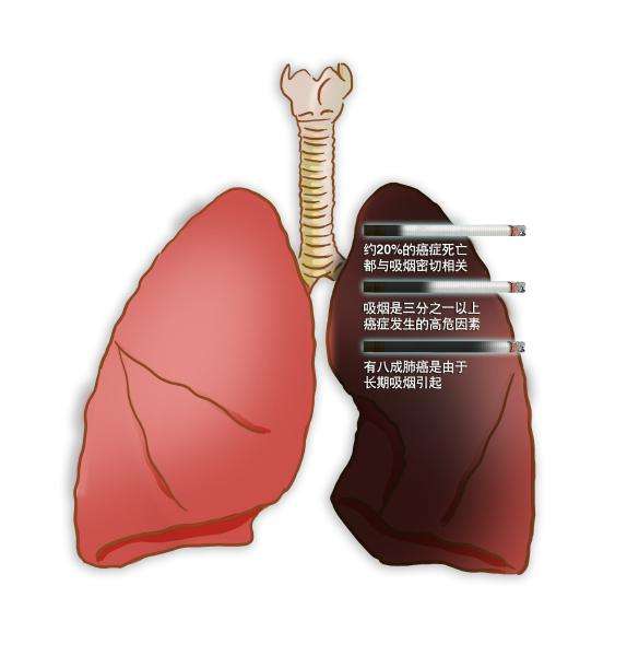 出国看病：个体对肺癌的易感性存在差异的研究