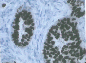 解决突变的p53蛋白如何促进肿瘤细胞形成的难题