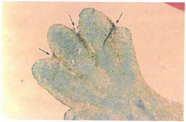 P53凋亡程序的多种证据