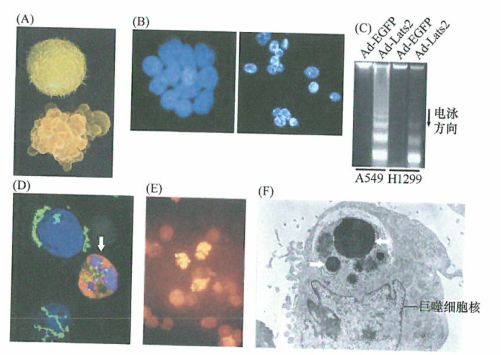 P53凋亡在正常组织的生理学过程中也发挥重要作用