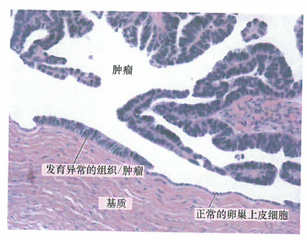 p53转录因子一个非常重要的靶基因就是M/m2基因