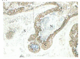 自嗤和其他形式的细胞死亡的结构图