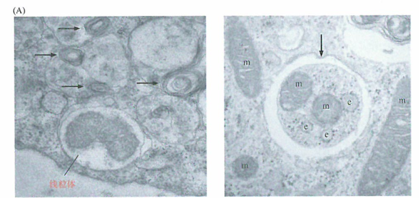 肿瘤细胞死亡和自噬关系的研究