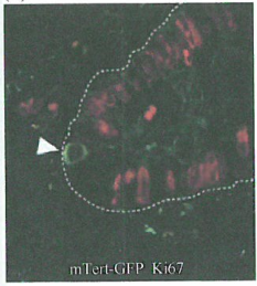 长端粒不能完全解释实验小鼠的肿瘤形成和衰老发生