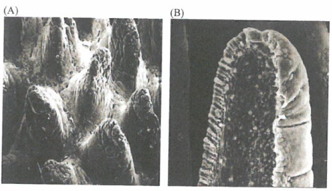 人类肿瘤发生发展的多阶段性概念
