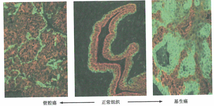 驱动原发肿瘤形成的顺序会暴露大部分肿瘤的正常起源