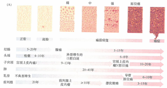 结肠中肿瘤发展的实际情况