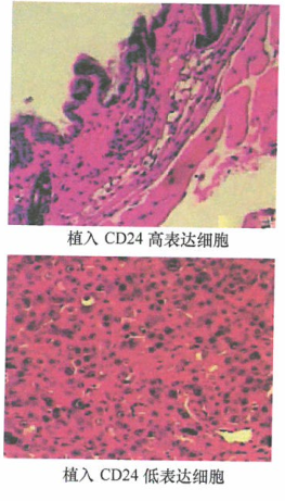 乳腺瘤干细胞增生由癌旁基质细胞中得到转移性人乳腺癌细胞