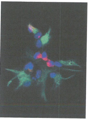 亚克隆及其相关细胞在肿瘤内的定位并不明确