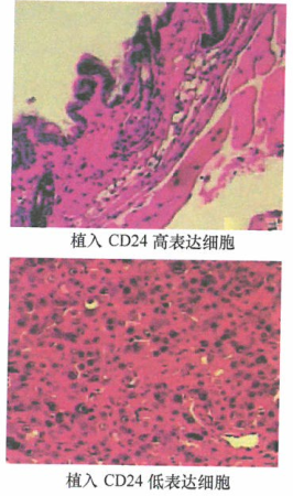 乳腺癌干细胞增生，癌旁基质细胞中得到转移性人乳腺癌细胞