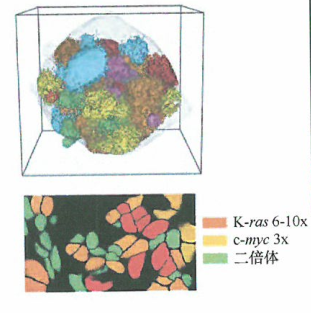 在肿瘤进展的过程中肿瘤细胞的基因组经常会变得越来越不稳定