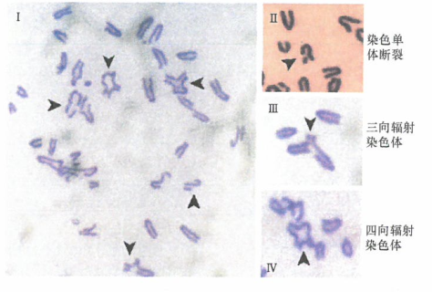 BRCA2功能部分缺失引起的核型改变
