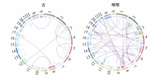 吸烟者头颈癌中的染色体易位