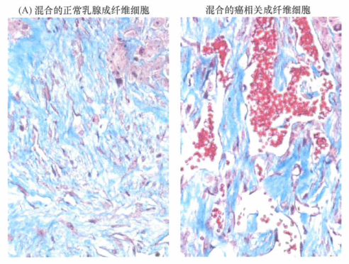 肿瘤脉管系统中出现的内皮细胞有两个来源