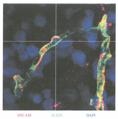 从肿瘤分离的间质细胞中存在突变的P7EN和JP53等位基因