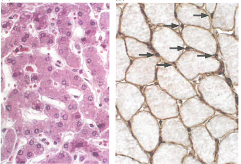 机体会阻止自身的细胞具有容易诱导血管生成的能力