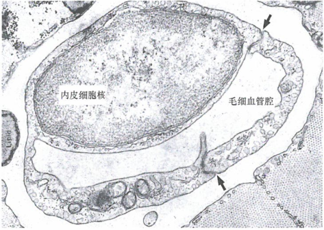 VEGF基因的表达产物可以促进血管生成