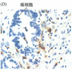 巨噬细胞能够大量分泌基质金属蛋白酶