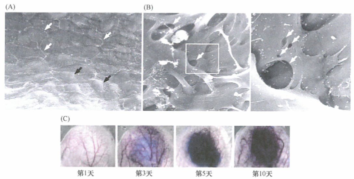 肿瘤微脉管中的缝隙及其导致的渗漏