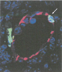 淋巴管也可由内皮细胞构成