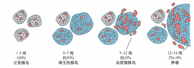 胰岛细胞肿瘤进展的Rip-Tag模型Rip-Tag转基因