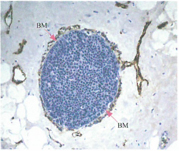 血管生成开关启动一个高度复杂的过程
