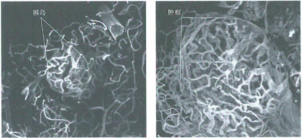 震惊！巨噬细胞同样参与肿瘤的血管形成