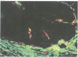 ​血管生成通常被生理抑制剂所抑制