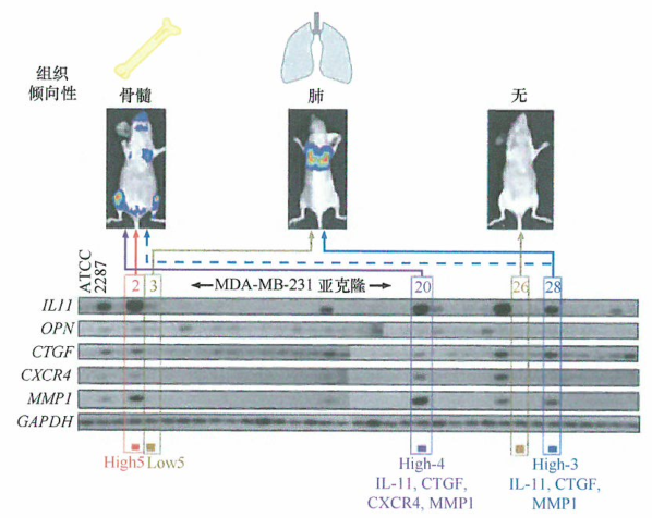 ​癌细胞转移的组织倾向性