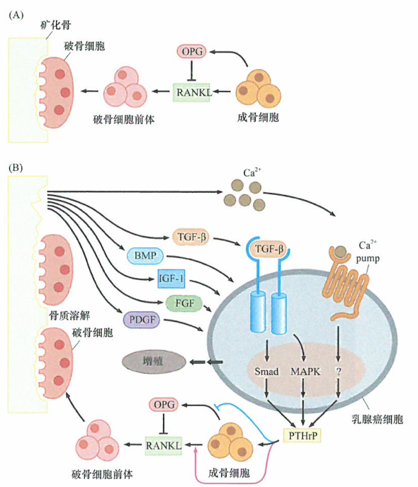 骨细胞之间的相互作用为转​移到骨的癌细胞发挥作用提供了支持