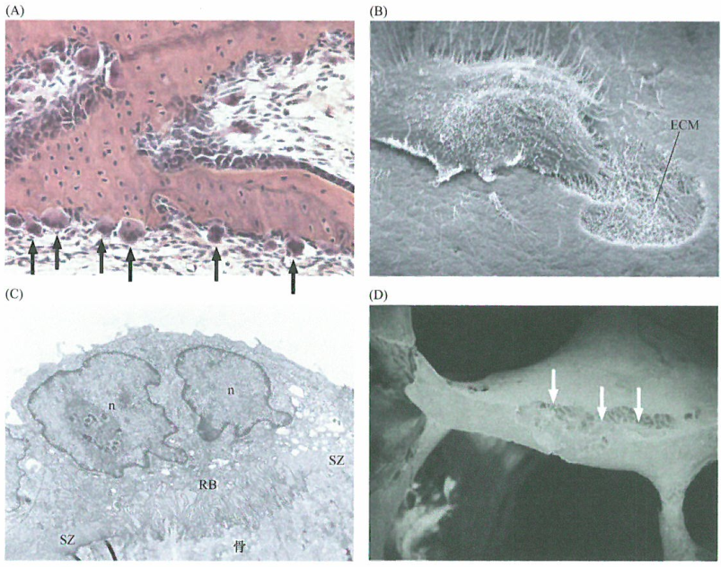 破骨细胞介导的骨降解骨降解