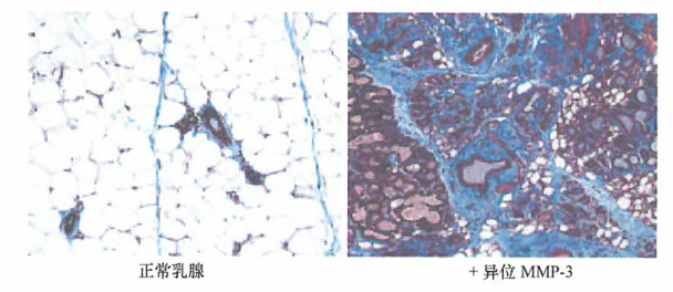 MMP自身的失调节可驱动肿瘤癌变所有阶段的肿瘤进展