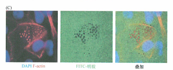 MT1-MMP、侵袭性伪足和细胞外基质的降解侵袭性伪足