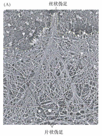 丝状伪足通过使外渗癌细胞与邻近组织的细胞外基质形成黏着斑