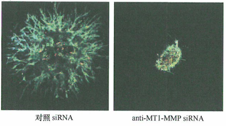 MT1-MMP、侵袭性伪足和细胞外基质的降解侵袭性伪足