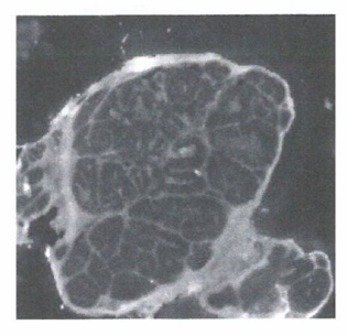 细胞外蛋白酶在侵袭中的关键作用