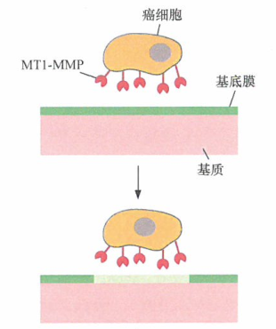 癌细胞侵袭过程​中MT1-MMP与MMP-2的合作膜锚定蛋白酶