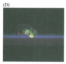 MT1-MMP、侵袭性伪足和细胞外基质的降解侵袭性伪足