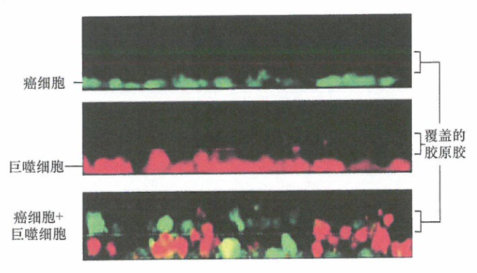 乳腺癌细胞和巨噬细胞间的互惠合作研究