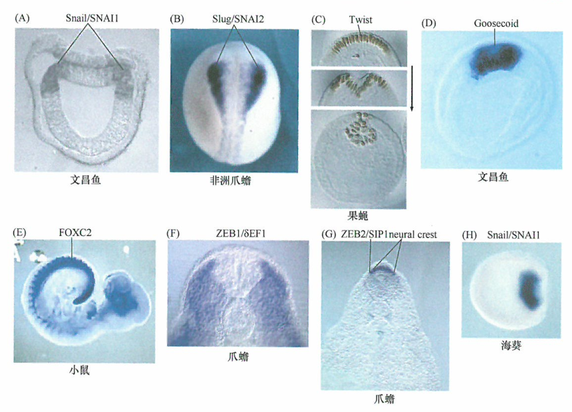 诱导EMT的胚胎性转录因子研究
