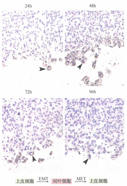 诱导EMT的胚胎性转录因子研究