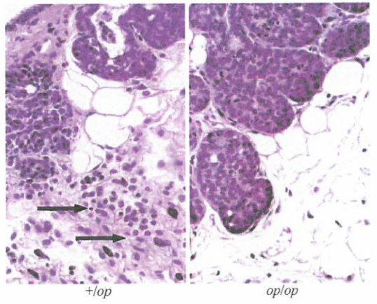 肿瘤基质中的配体​HGF可以诱导上皮细胞发生EMT