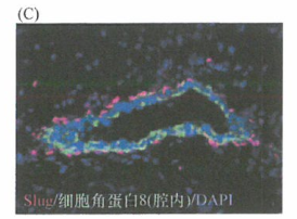 EMT诱导转录因子赋予上皮细胞干细胞特性研究