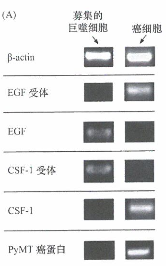 乳腺癌细胞的侵袭转移能力明显受基质细胞信号的影响研究