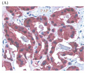 美国就医：FDA批准Provenge作为对前列腺癌疫苗